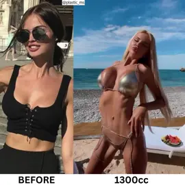 Veronika Sherstiuk #plasticsurgery #cosmeticsurgery #bimbogirl #bimbobarbie #bimbo #bimbogoddess #BreastAugmentation #bigboobs #plasticlife #plasticdoll