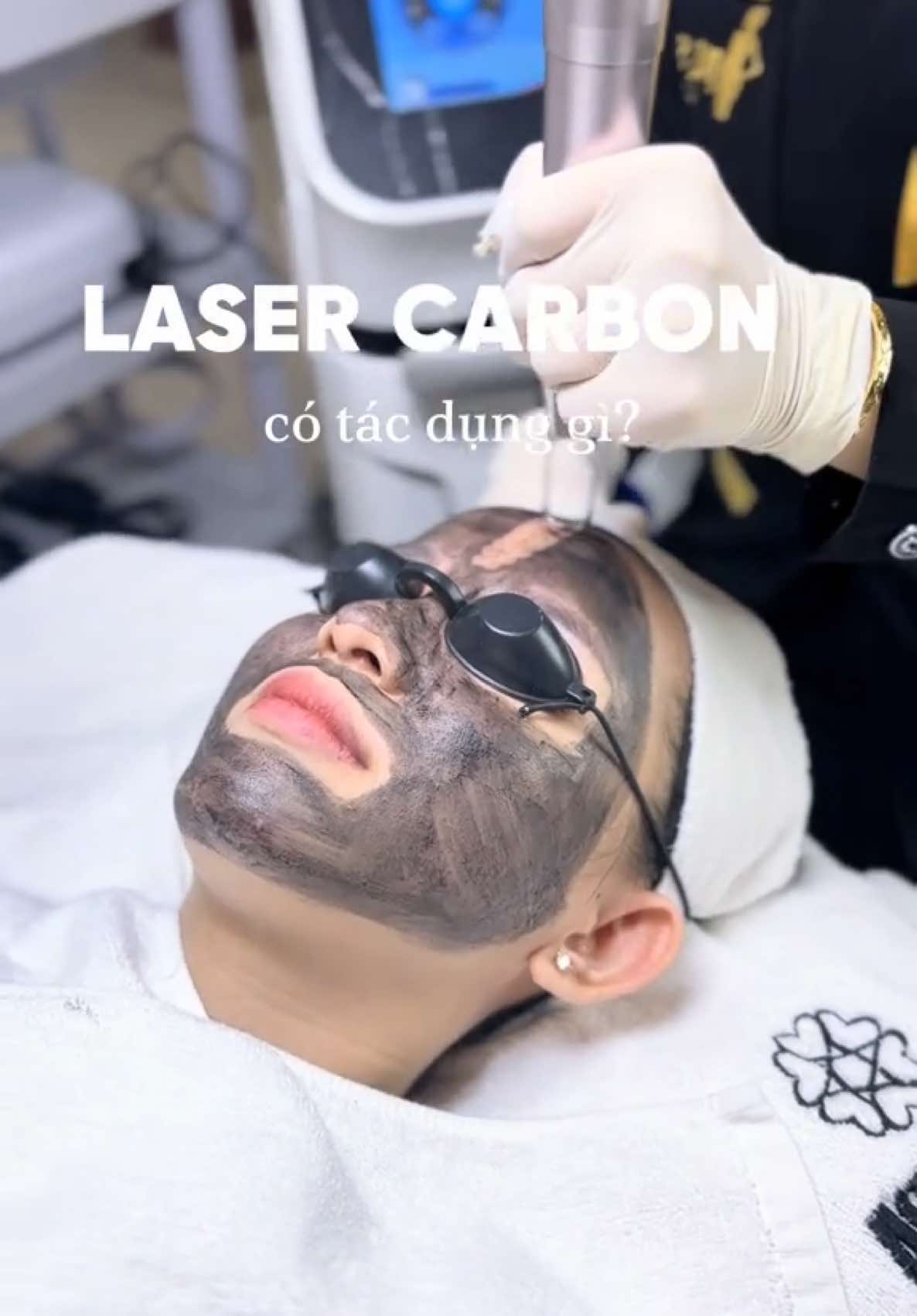 #LaserCarbon không đau, không sưng, không để lại sẹo, khách hoàn toàn không mất thời gian nghỉ dưỡng, không ảnh hưởng đến công việc.  - Công nghệ Laser Carbon (than hoạt tính) với một lần trị liệu có đến các tác dụng :  ➖Kiềm dầu,thải độc,làm sạch da ➖Sáng da ➖Trẻ hoá da  ➖Thu nhỏ lỗ chân lông ➖Mờ các nếp nhăn ➖Làm giảm thâm nám #trimundanang #spadanang #laser #cacbon #chamsocdamat #43danang #nanmundanang #xh 