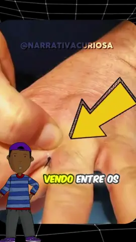 isso ja aconteceu com voce alguma vez ?#curiosidades#fyp