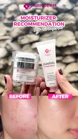 Ini dia rekomendasi moisturizer by airnderm! Kamu udah pernah coba yang mana?😍✨ #TikTokAwardsID #fyp 