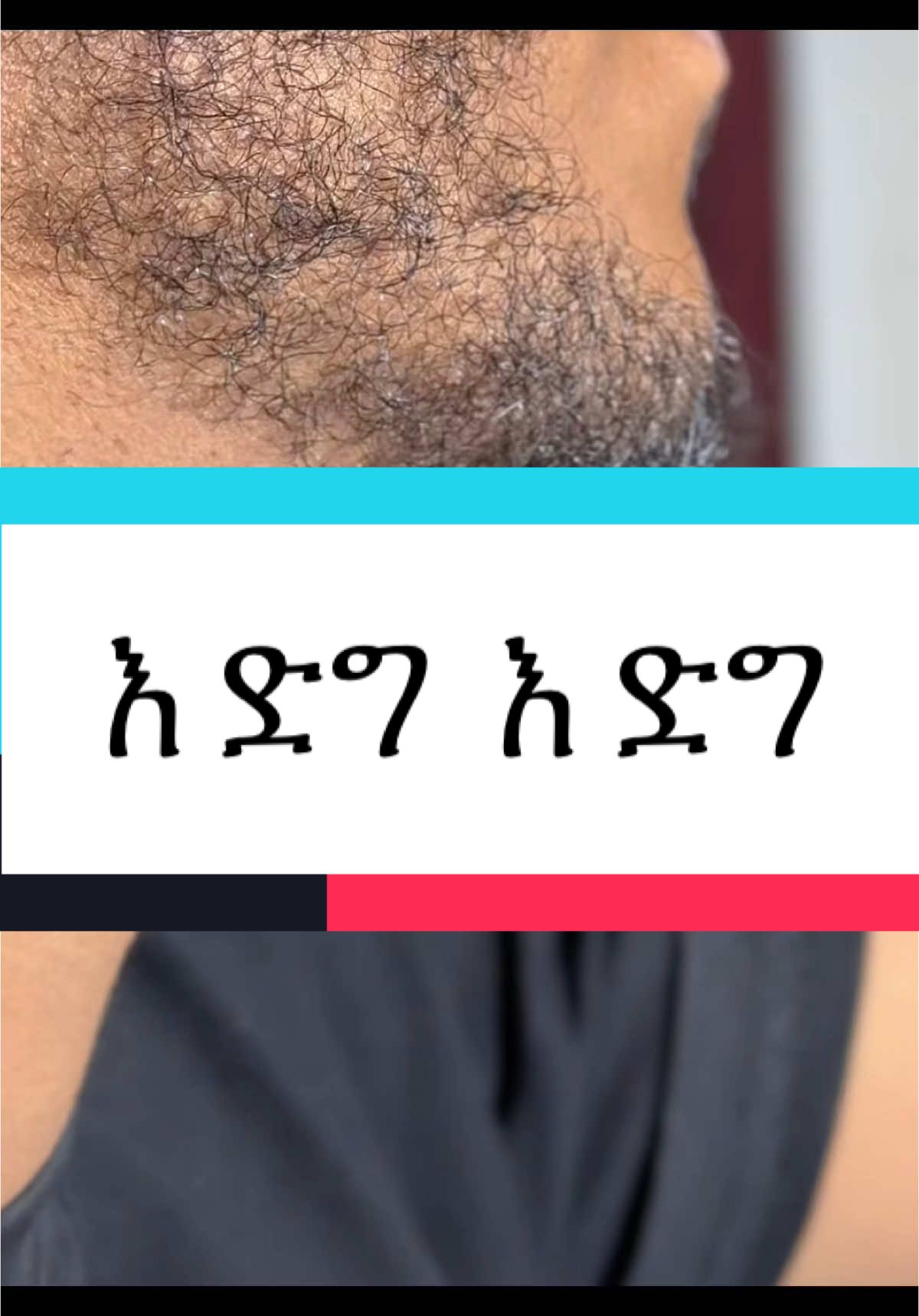 #minoxidiladdis #አዲስminoxidil #hairAddis #ethiominoxidil #አዲስ #originalminoxidil #beardminoxidil #beardminoxidil #originalAddis #