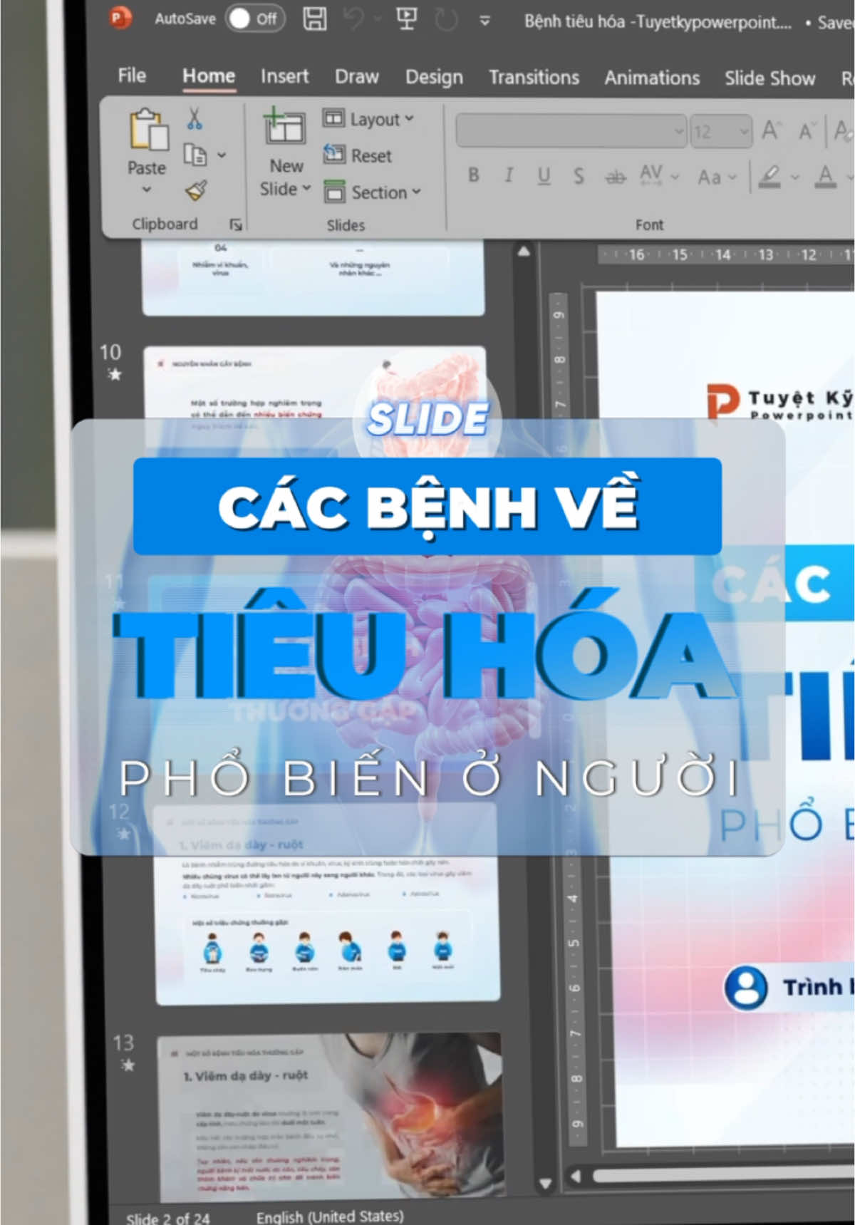 Mẫu slide Các bệnh về Tiêu Hóa phổ biến ở người #hetieuhoa #sinhhoc #yte #powerpoint #tuyetkypowerpoint 