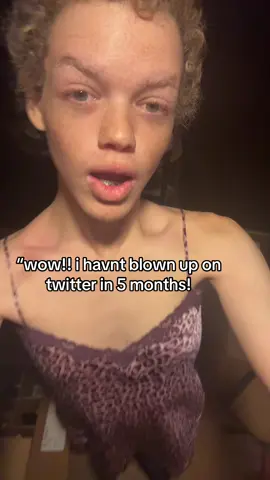 dont mind the red collarbone my skin is sensitive…