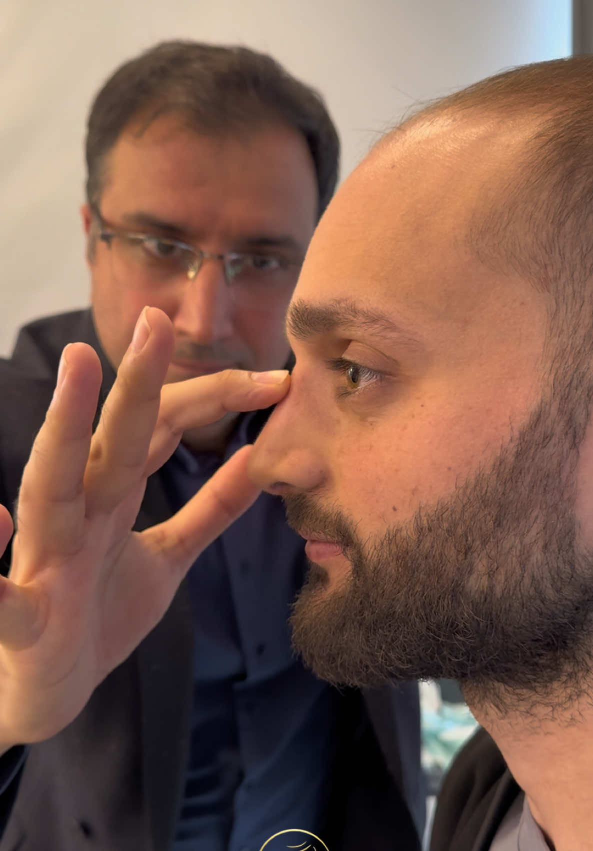 Suits you well 💫 #rhinoplasty #nosesurgery #noseart #nosejob #rhinoplastyistanbul #rhinoplastyturkey #æstetisk #rhinoplastyturkey #drevcimik #septorhinoplasty #burunestetigi 