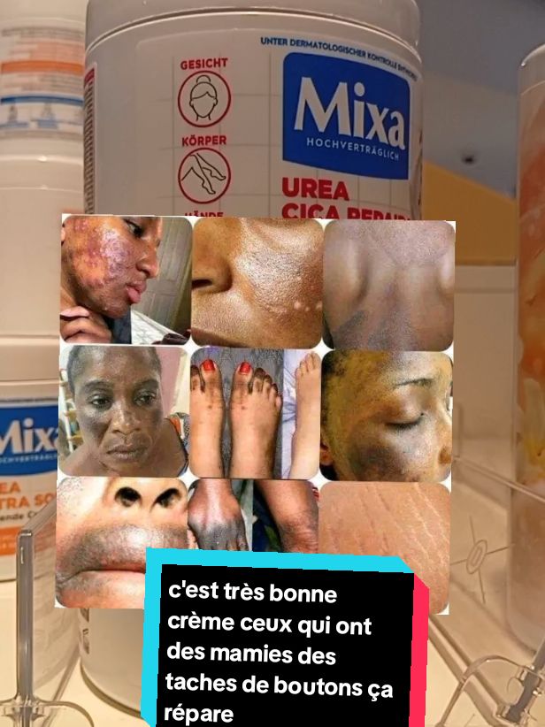 #dao #c'est très bonne crème ceux qui ont des tâches des mamies des boutons