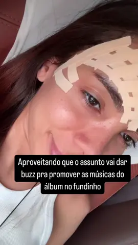 Anitta falando sobre o procedimento que fez para tirar sua veia da testa  #anitta 