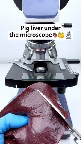 #LIVER #UNDER #THE #MICROSCOPE #3DANIMATION #VIDEOS #millionviews #viraltiktok #viral_video #fypage #unfreezmyaccount #pleaseunfrezzemyaccount #medicalstudent #medicalvideo 