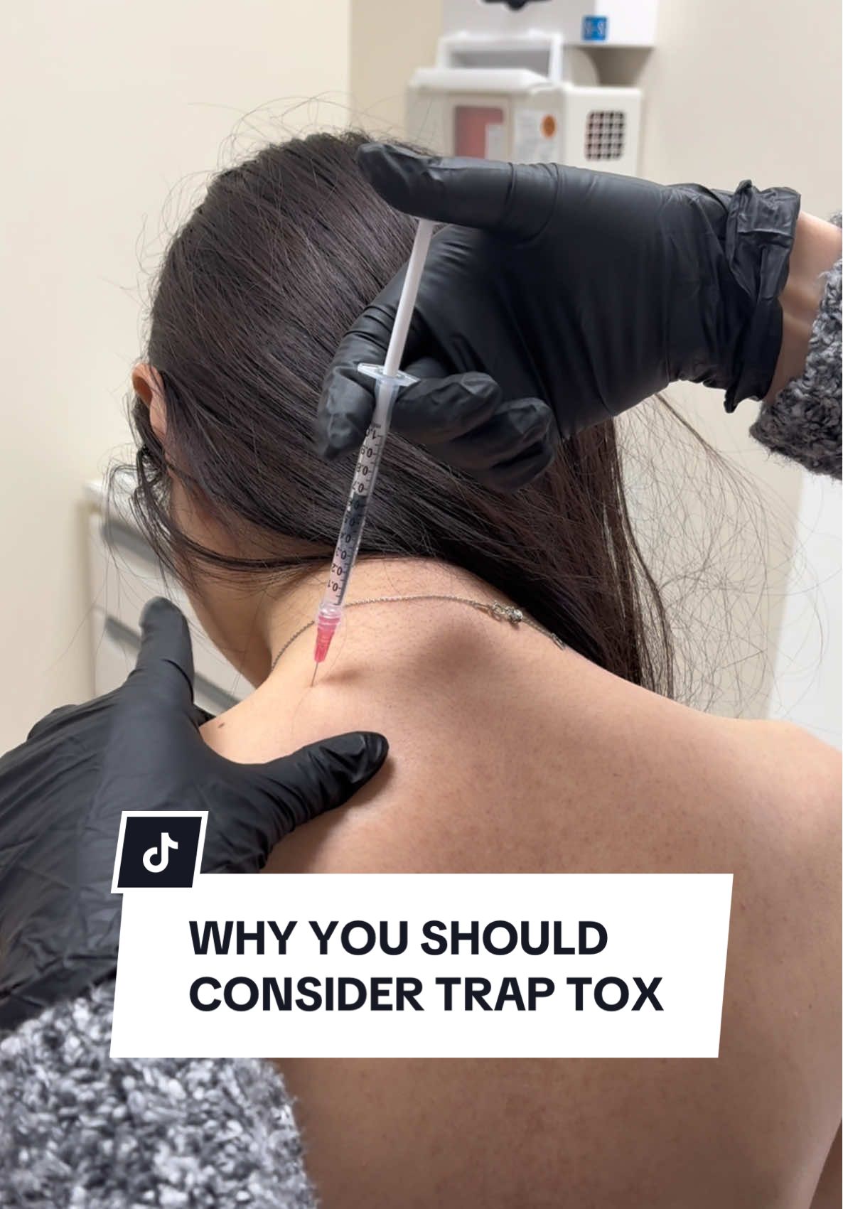 Feeling constant shoulder tension or neck pain? Trap Tox might be the solution for you! This innovative treatment not only relieves discomfort but also enhances your posture and gives you a more sculpted neck appearance. #TrapTox #PostureGoals #NeckPainRelief #PostureImprovement #ShoulderTension #NurseInjector #AestheticInjector #WellnessJourney #TensionRelief #fyp #fypシ #LosAngeles #Burbank #Pasadena 