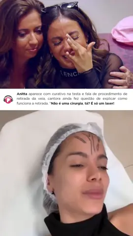 Anitta removeu uma veia de sua testa e explicou todo procedimento para seus fãs, eaí teriam coragem de fazer o procedimento ? #anitta 