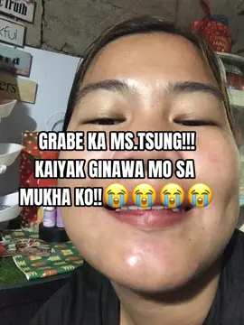 Kong Ayaw mong Maachieve ang Glass Skin Wag mong panoodin to!! Sobrang nakakaiyak lang Ginawa ng Ms.Tsung sa Muka ko😭😭 #mstsung #mstsungessentials #skincare #glassskin #fyp 
