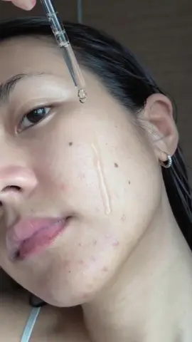 #tiktokshop1212ลดใหญ่ท้ายปี #ampoule #ผิวแข็งแรง #skin1004 #Kbeauty #รีวิวบิวตี้ 