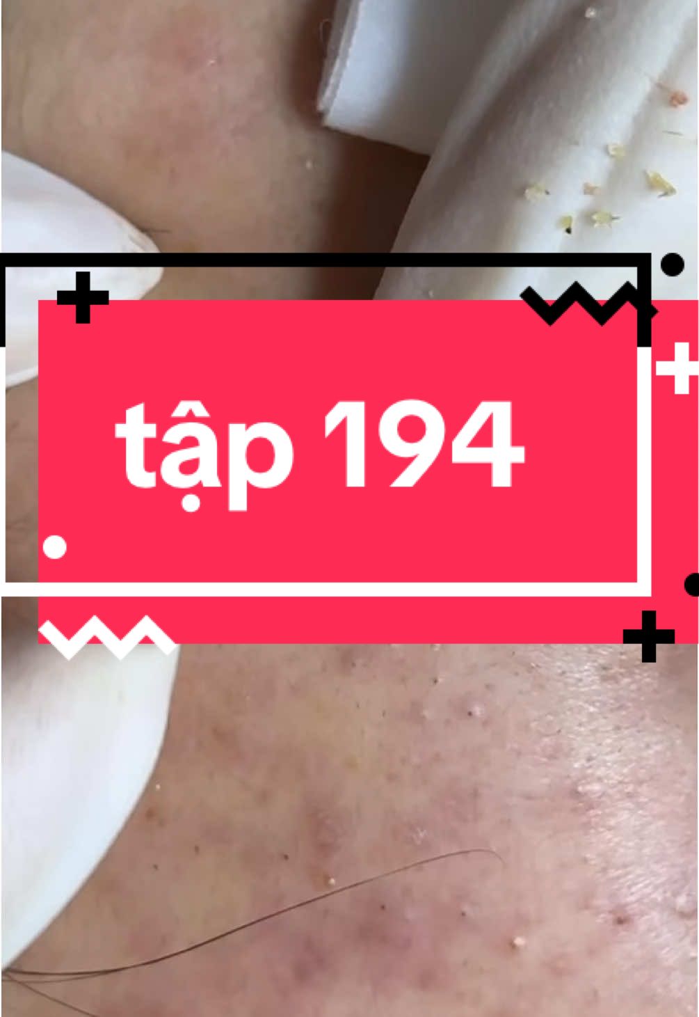 #quan12 #bếntre #nguyenchuyenmun 