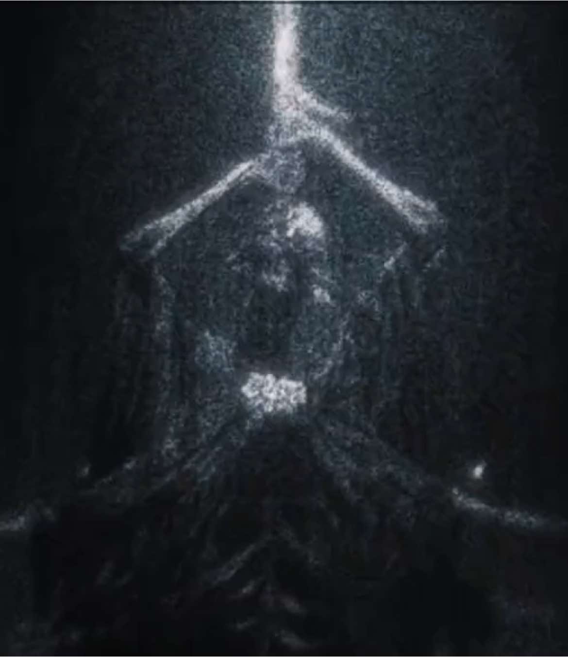 endure | scp: paleblood0 & OpXG4mer | #eldenring #eldenringedit #eldenringdlc #shadowoftheerdtree #eldenringsote #midra #midraedit #fy #fypage #edit #soulsborne #soulsborneedit