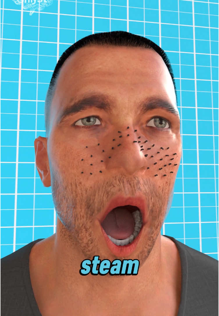 STOP Squeezing Blackheads! Try This Safe & Effective Method Instead! 🧖‍♀️