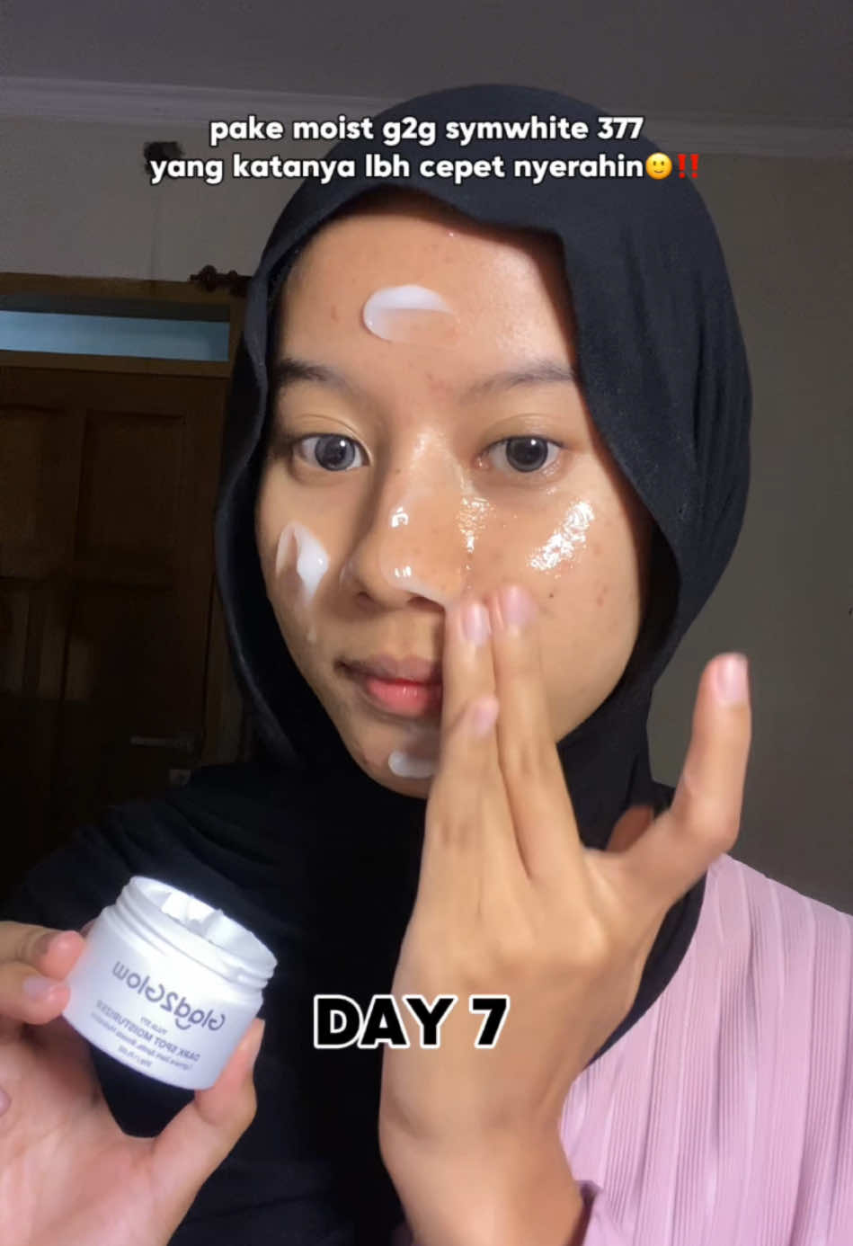 butuh proses walau msh ada bbrp bekas jerawat tp better bgt dr yg day 1!! combo in ya moist symwhite 377 + csm pake toner cica ✨💓 #darkspotmoisturizer #moisturizerviral #symwhite377 