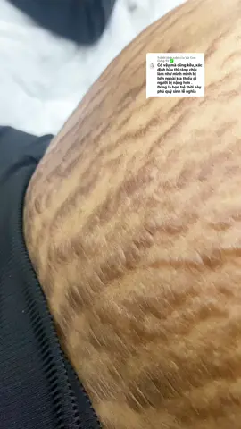 Trả lời @Vía Con Cưng 92 ✅ #xuhuong #xuhuongtiktok #vairal #mevabe #babau #randa 