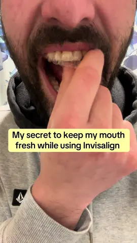 Greatest investment I've ever made 😅  #viral #waterfloss #waterflosser