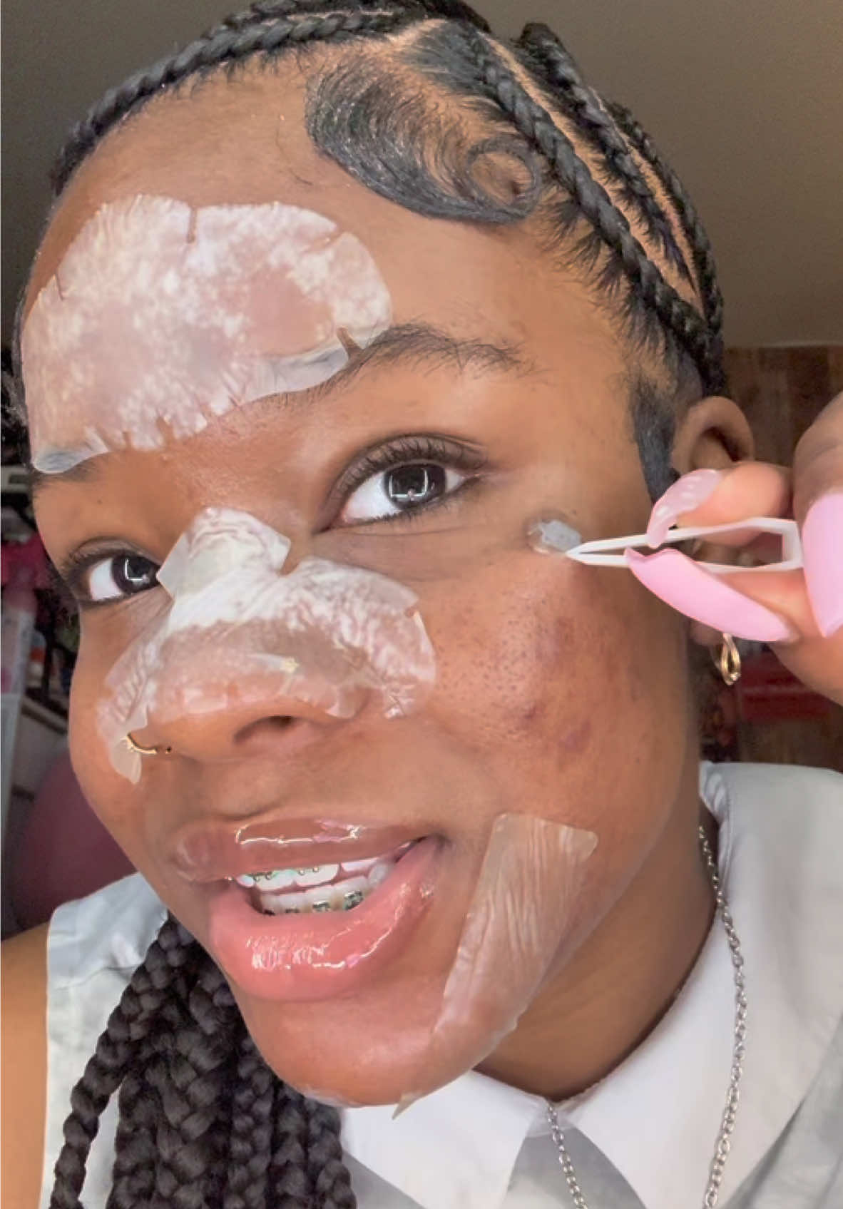 Patch reveal + chat :(  #pimplepatchremoval #acne #nosepatches #satisfying #skintok 