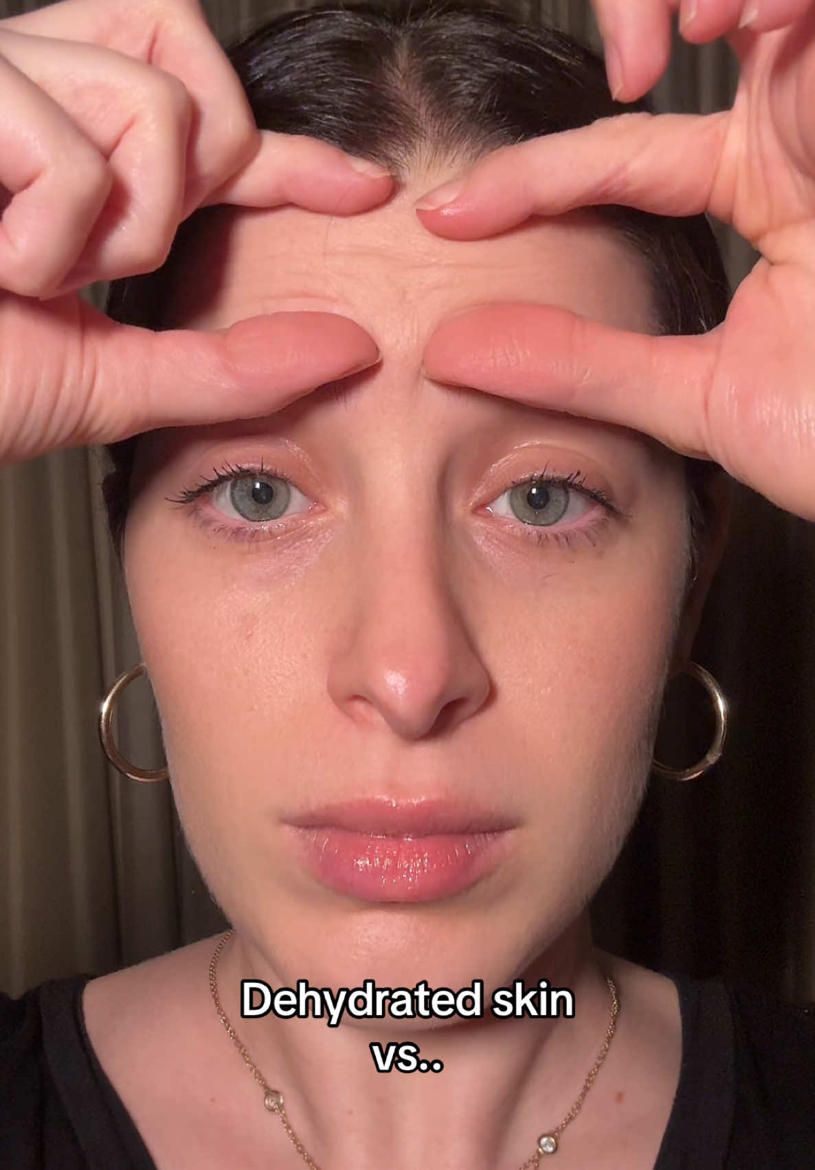 The way my forehead wrinkles disappear 😳 #dehydratedskin #botoxalternative #wrinkleprevention #hydratingskincareproducts   Glazing milk @rhode skin  24k gold serum @Mimi Luzon  Hydrating cream @Drunk Elephant  Face oil @Monastery 