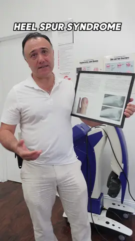 💡 Are you suffering from heel pain that just won’t go away? It could be Heel Spur Syndrome, a common condition where calcium deposits form on the heel bone, causing sharp pain, especially when walking or standing. At Best Foot Doctor NY, we specialize in minimally invasive surgery to treat Heel Spur Syndrome effectively. This innovative approach offers: ✅ Less scarring ✅ Shorter recovery time ✅ Relief from chronic pain Stop letting heel pain hold you back! Visit us today to learn how we can help you get back on your feet—pain-free! 🦶 If you’re experiencing heel pain or suspect Heel Spur Syndrome, visit your podiatrist to explore your treatment options. #PodiatryCare #HeelSpur #HeelPainRelief #MinimallyInvasiveSurgery #BestFootDoctorNY #NYCHealth #FootHealth #PainFreeFeet