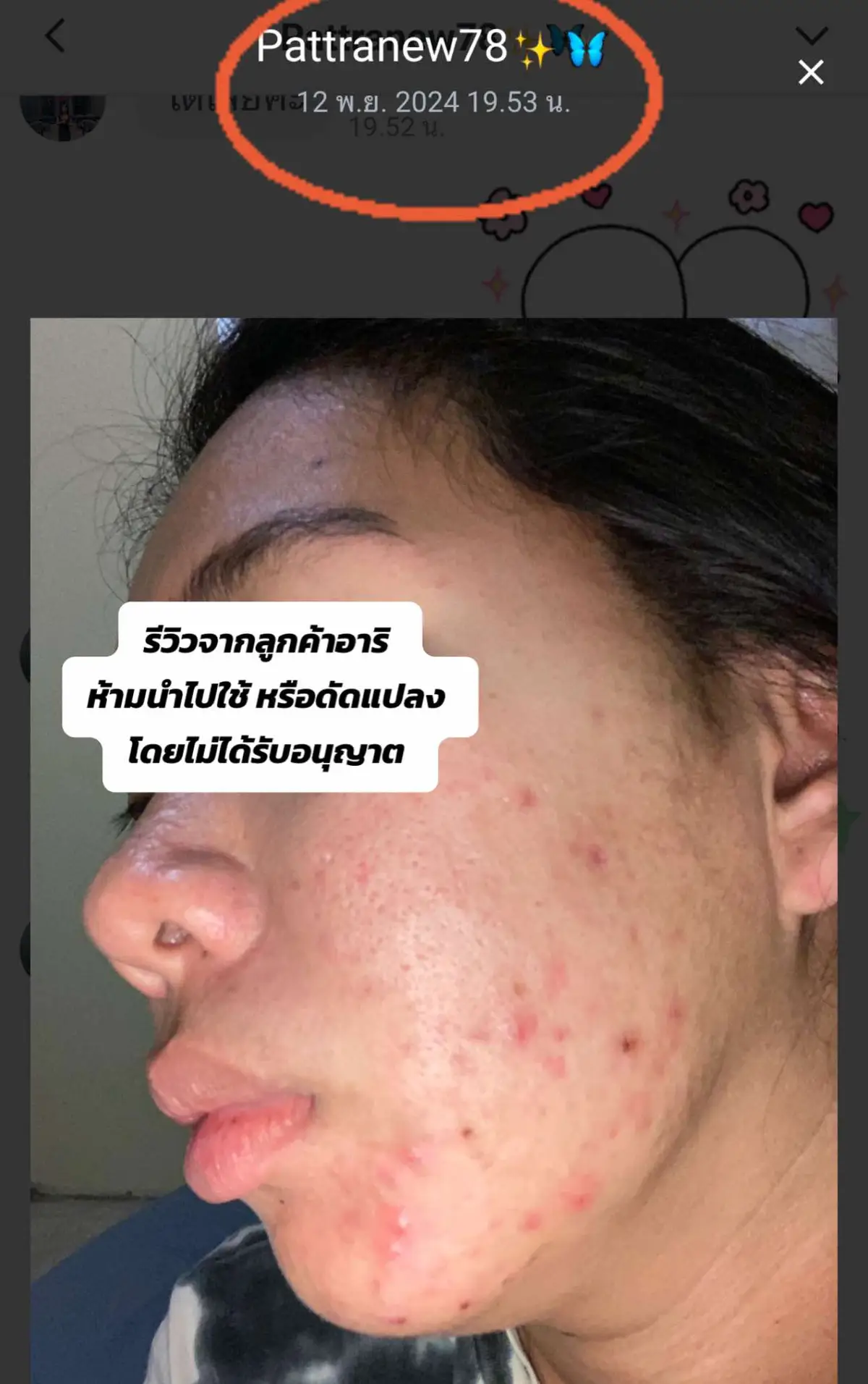 #AHRISKIN #อาริสกิน #สลิปปิ้งมาส์กอาริ  #อาริสกินแคร์เภสัช #รีวิวบิวตี้ #อาริรีวิว #รักษาสิว 