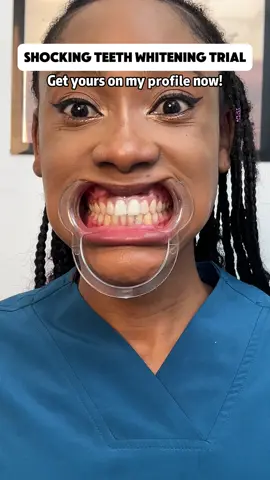She had to try it for herself! 🧐👀💖 #test#teethwhitening #BodyAccel#oralhealth #teethwhitener#niacinamide #toothpaste