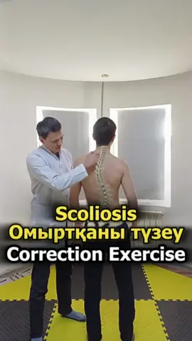 🎯 How to avoid Scoliosis? Best exercises #ortospine,#scoliosis, #kyphosis, #lordosis, #backpain, # sciatica, #unevenhips, # neckhump, #ortopedutebaev, #backpainrelief, #posturecorrecton, #neckpain, #unevenhip, #exercises, #spinehealth, #wellness, #unevenlegs, #scoliosisexercises