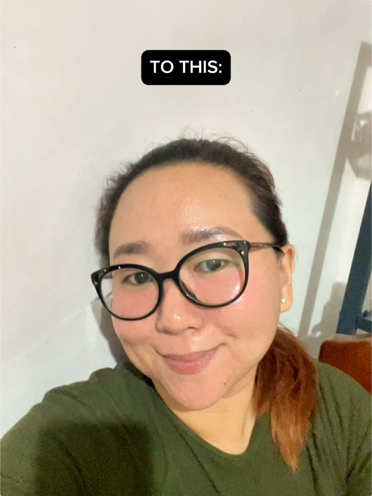 This soap literally saved my from my acne problems! Not your ordinary facial soap! Get yours today while its on sale mga miiii! 👌 @Dr. Mike D @DMD Skin Sciences  #acne #acneskin #oilyskin #azelanesoap #holygrail #acnevulgaris #sensitiveskin #progress 