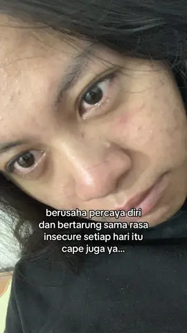 Sering ketemu sama orang dengan tatapan jijik melihat mukaku yg penuh jerawat🥹#acne #jerawat 