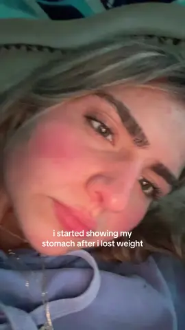 its NORMAL! #weightloss #looseskin #journeywithweight 