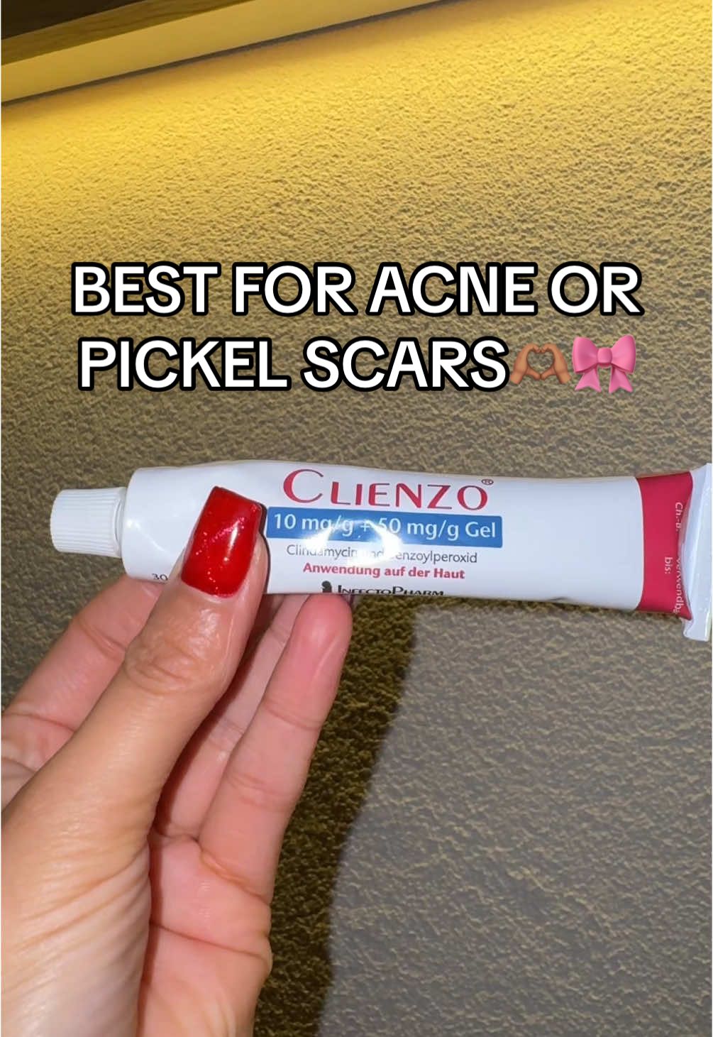 Antwort auf @leoniefußball Instagram in meiner Bio🫶🏽🎀 #skincare #acne #pickel #skincareroutine #acnescars #noirbymaytte 