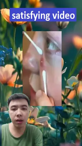satisfying video cleaning #pimple #blackhead #pimplepop #acne #blackheads #trends #treatment #tiktokviral #satisfyingvideo #extractions #skincare #infections #botfly #parasite #pedicure #fyp 