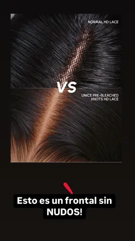Esta es la diferencia de una peluca con el frontal sin nudos ✅ 🥰   Con frontal ZIG ZAG 🥰  ❌Shein❌ 