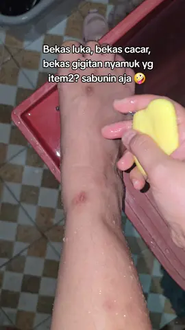 #sabunzeglow #penghilangbekasluka 