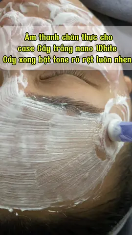 Dịch vụ hong đăng nhưng luôn được khách em book lịch hong sót ngày nào 🥰#Kbeautyspa #kbeautyskincare 