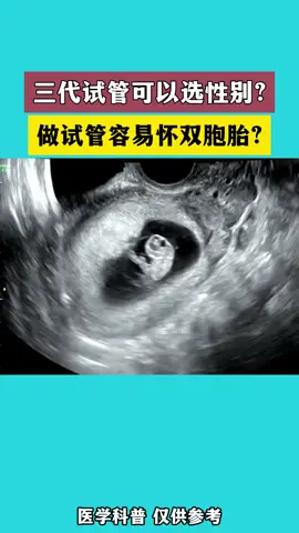 三代试管可以选性别吗？#三代试管 #三代试管选性别 