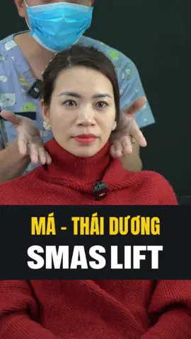 Smas Plus Không dùng filler! An toàn, thẩm mỹ! #fillbeuty #cfuelife #azdclinic #smasplus