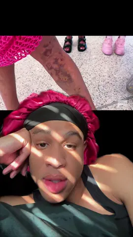 #greenscreen #fyp #rhoslc #bronwynnewport #dog 