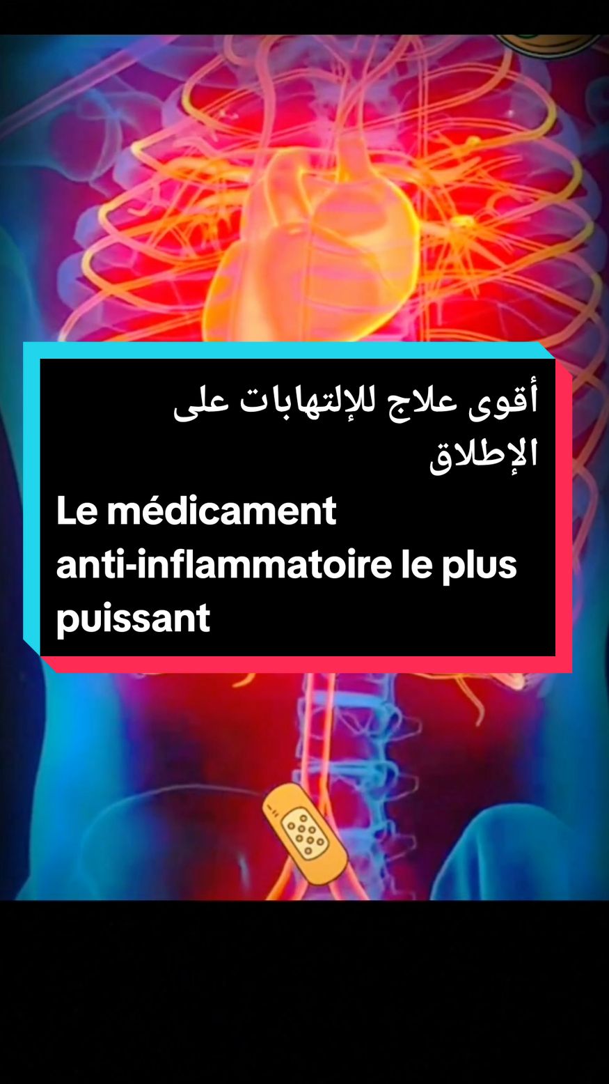 أقوى علاج طبيعي مضاد للالتهابات، يحارب جميع الأمراض الإلتهابية في جسم الإنسان و يقوي الجهاز المناعي Le médicament anti-inflammatoire le plus puissant #نصائح_صحية #france🇫🇷 #TraitementNaturel #علاج_طبيعي #مضادات_الالتهاب #معلومات_طبية 