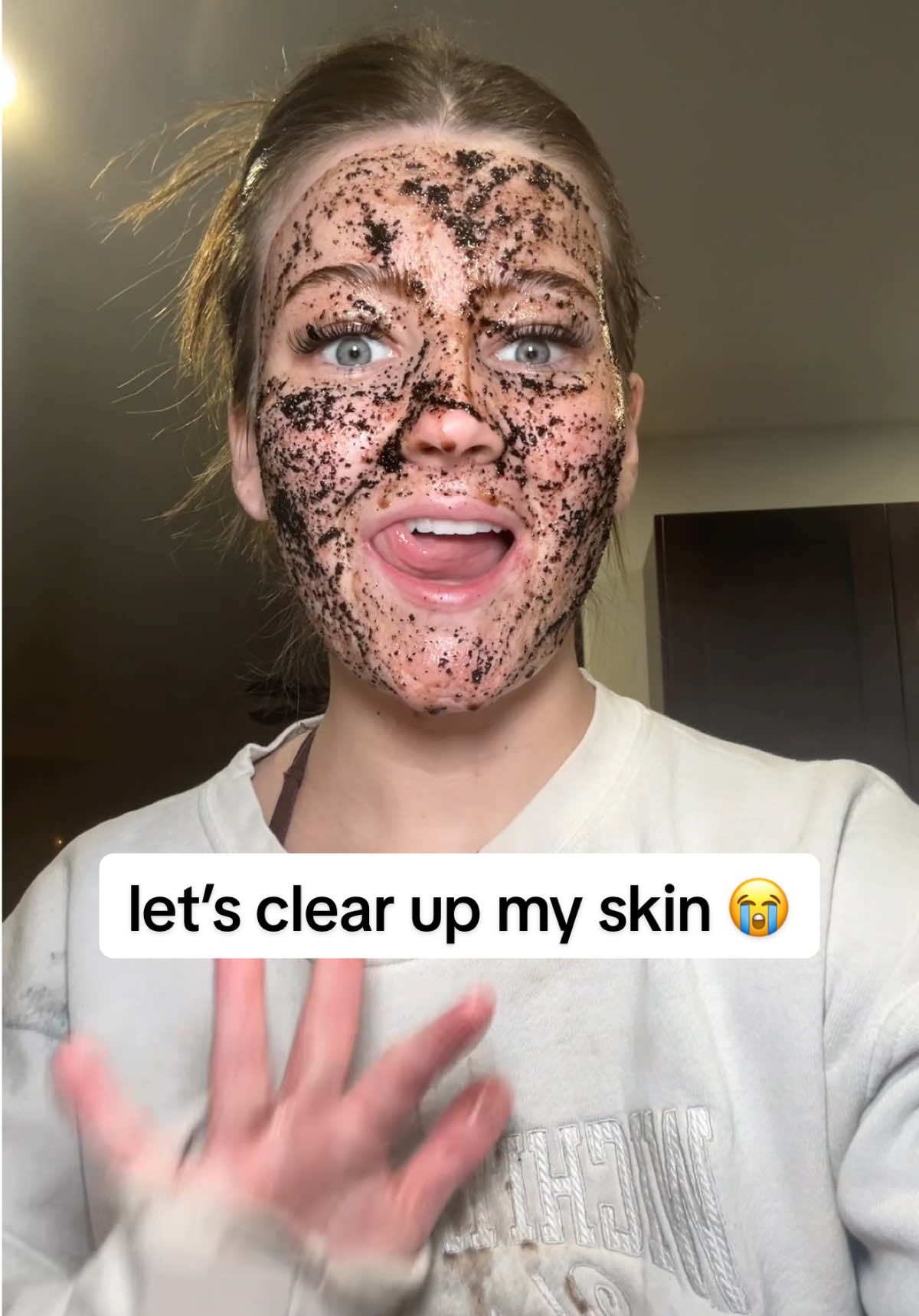 i’ve struggled with acne for years! im very focused on fixing it now! it’s definitely not as bad as it use to be but i have breakouts often, redness, and scars lmk some tips in the comments 😊🤎 ##crizmanshaye##acne##healing##natural