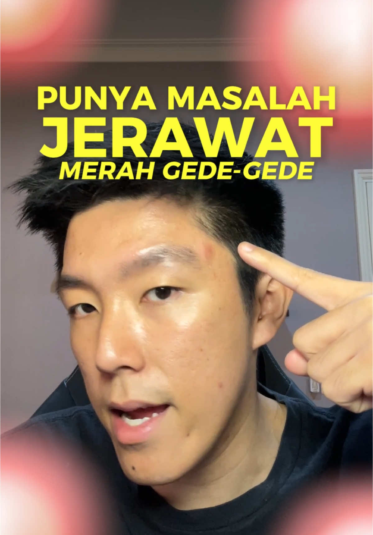 Siapa disini yang sedang menghadapi 3 masalah jerawat yang ditakutin nih?? Wajib banget cobain @Dorskin Official #keracunleo #racuninskincare #reviewskincare #skincareviral #acnetreatment 