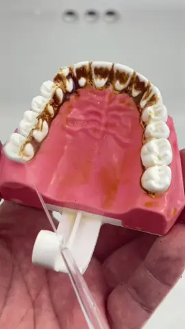 If you don't want this, please read through it #TikTokMadeMeBuyIt #uk #foryou #fyp#teeth #tooth #dentist #teethcleaning #teethwhitening #teethcare #toothache #teethtok #waterflosser #goodthing #homegadgets #homehacks #lifehacks #viral #viralvideo #trend #trending #spotlight #spotlightfinds #TikTokMadeMeBuyIt #TikTokShop #TikTokfinds #tiktokmusthaves #tiktoknews #amazonfinds #amazonmushaves  #BlackFriday #tiktokshopblackfriday 