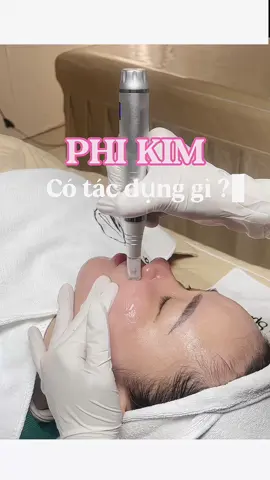 Dù có bao nhiêu công nghệ thì cũng ko thể thay thế tác dụng tuyệt vời của MTS.  Các bạn đã biết Phi Kim vừa có thể cấy dưỡng chất vừa kích thích tăng sinh collagen và tái tạo da. #wingsbeautyspa #viral #xuhuong #mts #phikimtebaogoc #laser #meso #chămsócda 