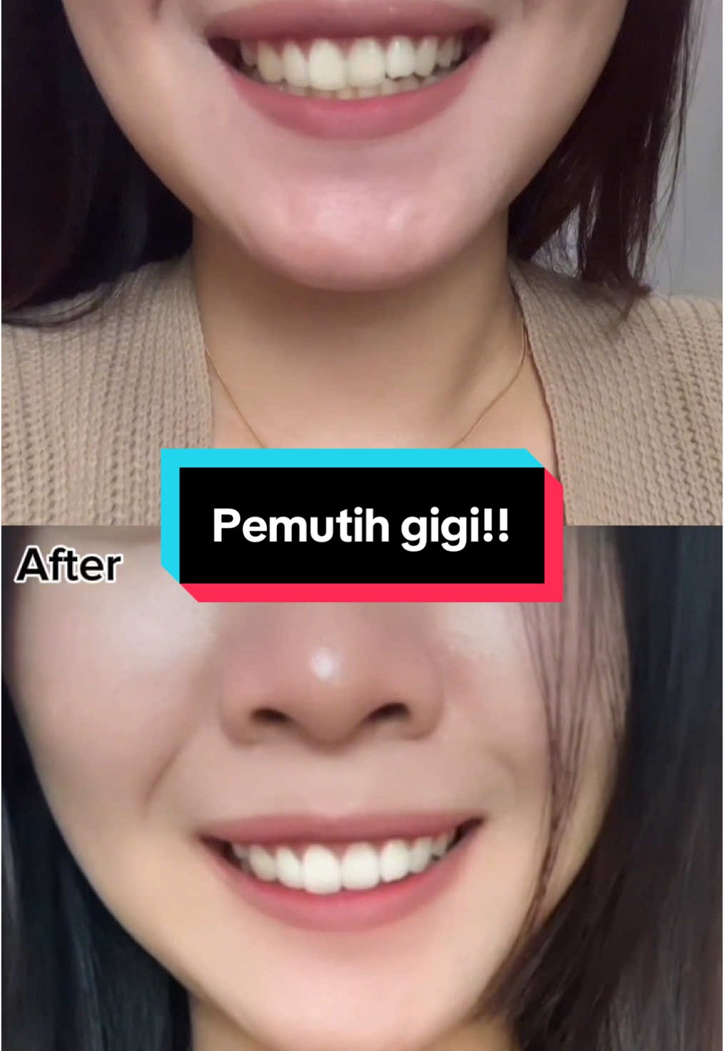 Yang giginya kuning sini merapatt😋😋 @Breylee.id #whiteningpowder #pemutihgigi #fyp #teethwhitening #breylee 