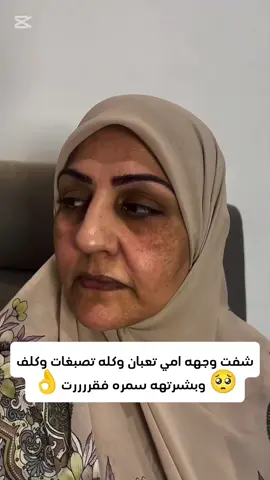 #عصارة_نيبروسين_لمعالجة_الكلف ##تسويق #تسويق_الكتروني #التجارة_الالكترونية #الترويج #الترويج_الآلكتروني #ترويج #ماركتنك #ماركتنج #تجارة