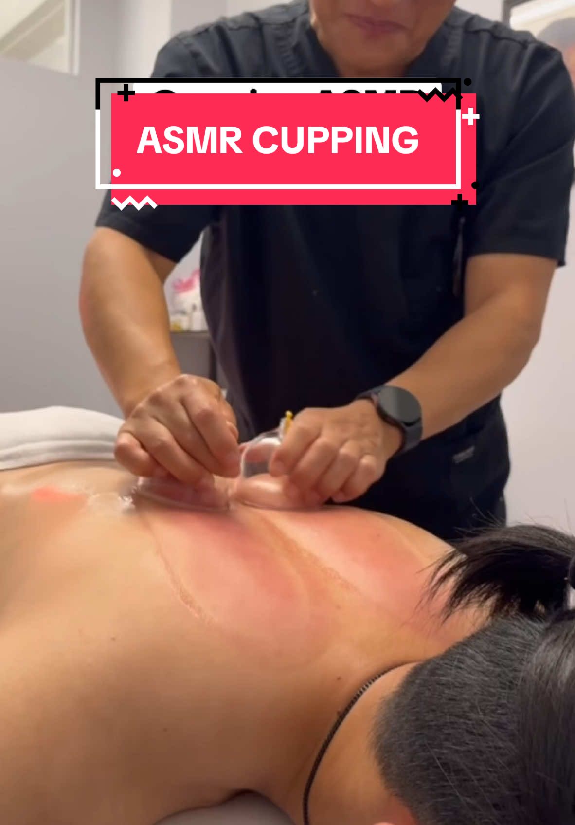 Cupping ASMR with our Acupuncturist Jay 😴 Would you do cupping? #GetAdjustedNow #NYCchiro #Chiropractor #acupuncture #cuppingmassage #cupping 