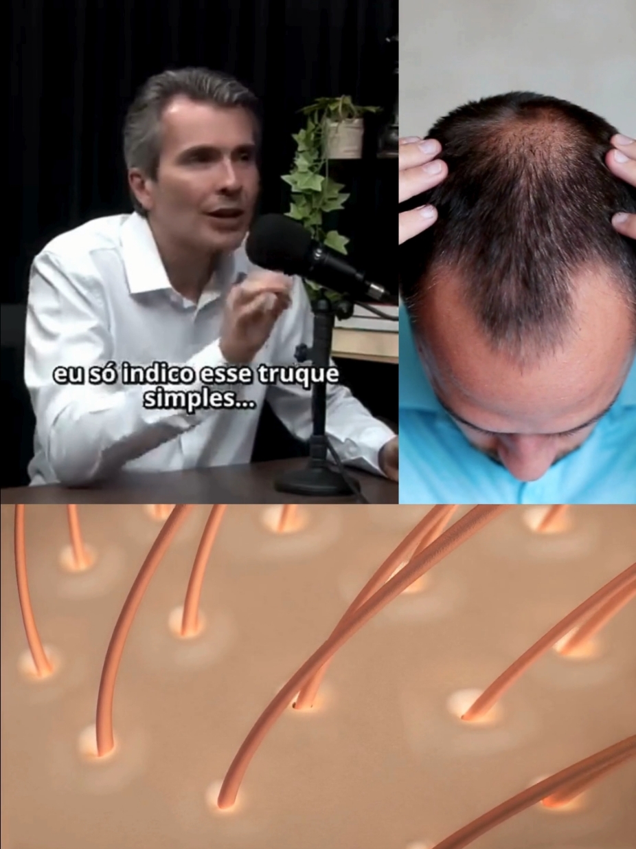 Site oficial na Bio! #minoxidil #finasterida #dutasterida #calvicie #quedadecabelo #saudemasculina #cabelo #careca 