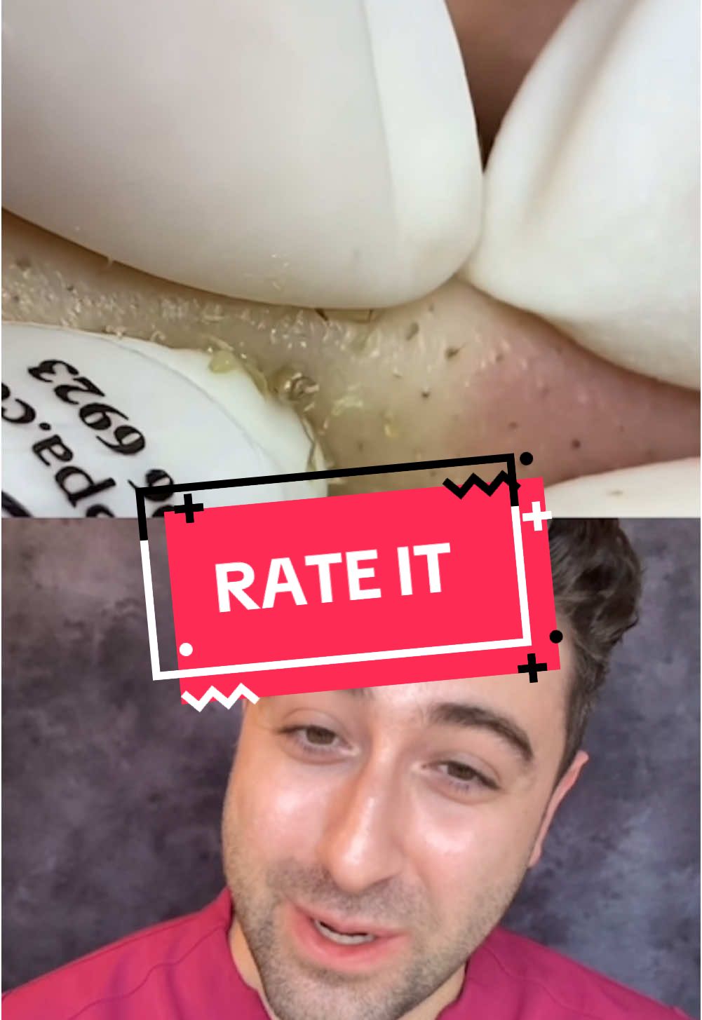 #pimplepatch #pimpleremoval #pimplepopper #pimple #acnewarrior #blackhead #cyst #acne #skincare #pimplepopping 