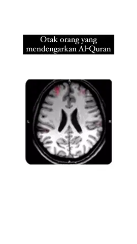 Sudah tahu kan hebatnya Quran? Ayo yang rajin menjalankan program Qurannya. Untuk referensinya berikut ini: Kadir, R. A., Salim, F. D., & Abu Bakar, M. H. (2023). Neural correlates of Quran recitals: A functional magnetic resonance imaging (fMRI) analysis. Multimedia Tools and Applications. https://doi.org/10.1007/s11042-023-15588-3 Yang tertarik kelas anak integrasi kurikulum Inggris dan pembelajaran Islam Al-Azhar Univ, Mesir, komen MAU KELAS ya! #edufic #sains #brain 