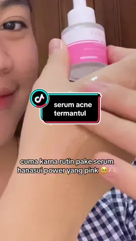 akuu rutin pake serum dari hanasuii bestie #acne #acnetreatment #hanasui #serumacne #yunmells #fyp 